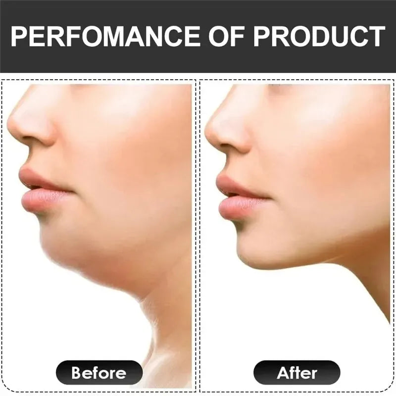 Jaw Shaper Exerciser – Strengthen & Define Your Jawline
